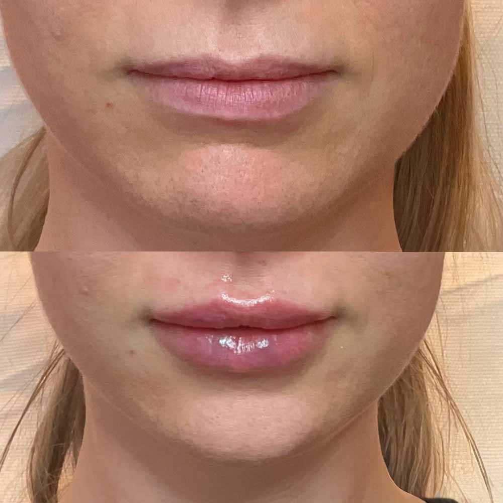 botox klinikla cour risskov