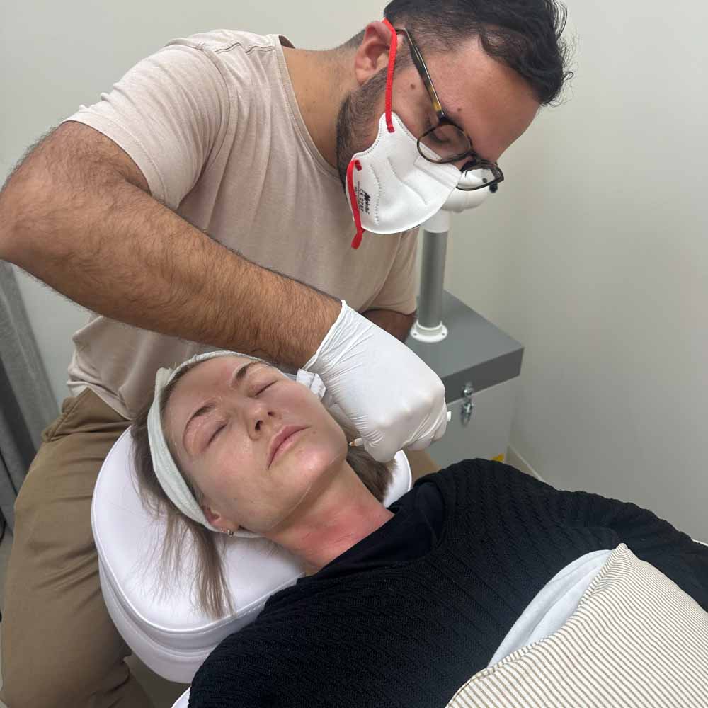 Fraktioneret CO2 laser 2 co2 laser